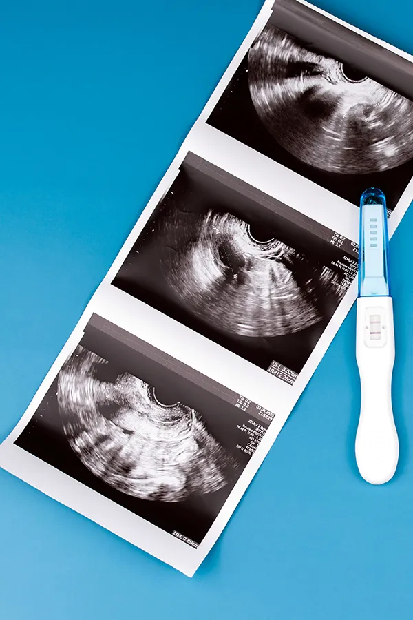 family-planning A sonogram and a pregnancy test. Get a family planning consultation from Richard Conlen, MD, FACOG in Boca Raton.